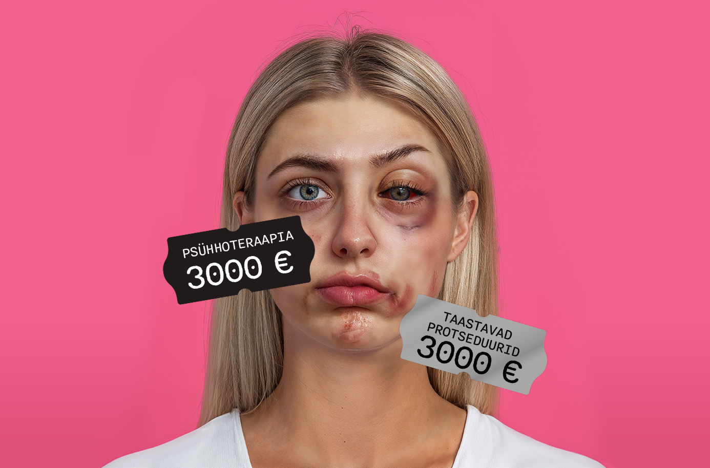 Noore naise nägu on jagatud kaheks – üks pool on terve ja sile, teine on tugevalt kahjustatud, sinikate, armide ja tursetega. Pildil on kaks hinnasilti: üks must silt kirjaga "Psühhoteraapia 3000 €" ja teine hall silt kirjaga "Taastavad protseduurid 3000 €". Taust on erkroosa, rõhutades kontrasti ja hoiatavat sõnumit odavate iluprotseduuride võimalike tagajärgede kohta.